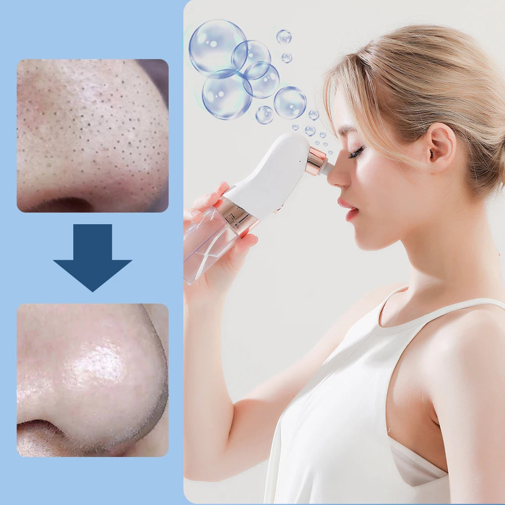 Nettoyeur Visage Professionnel